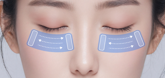 아쿠아셀(Aqua Cel IPL) 치료 방법